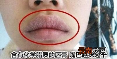 嘴唇经常性干裂和起皮这是什么原因