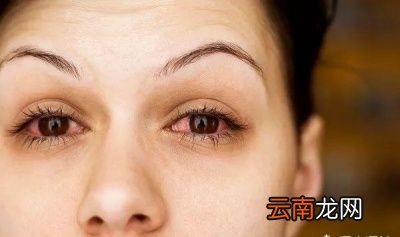 如何预防红眼病