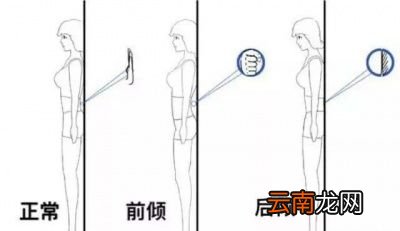 平板支撑是否伤腰及纠正方法