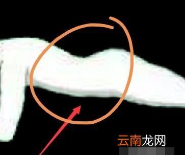 做等长收缩有什么危害