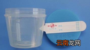 尿常规检查多少钱一次 尿常规检查多少钱