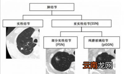 多久做一次比较好