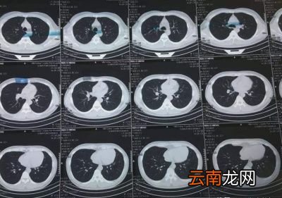 多久做一次比较好