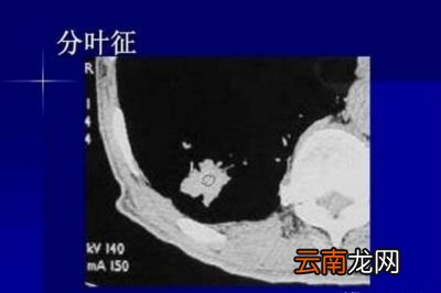 多久做一次比较好