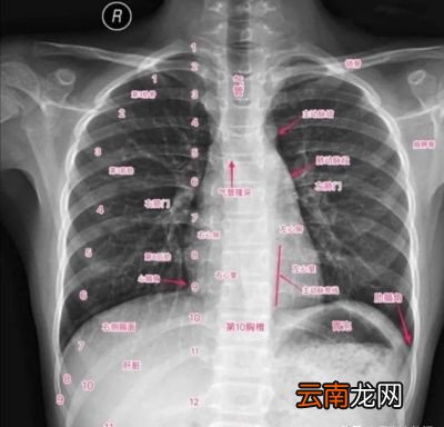 多久做一次比较好