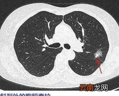 多久做一次比较好