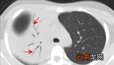 多久做一次比较好