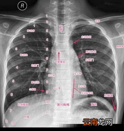 决定多久做一次CT的条件有哪些