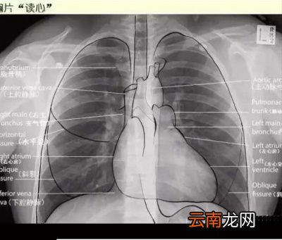 决定多久做一次CT的条件有哪些