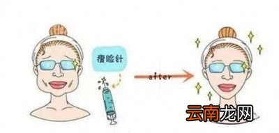 究竟要打几次才能定型
