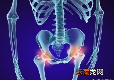 哪些人群会骨盆前倾