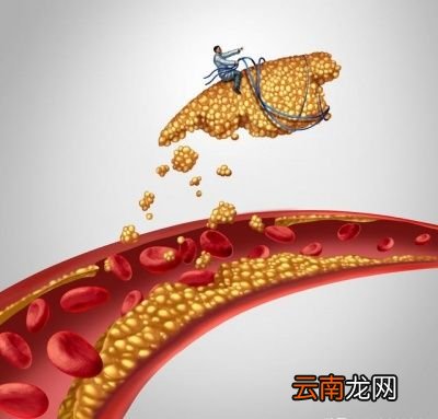丹参片能有清理血管的作用吗
