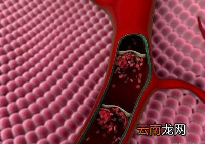 丹参片能清理血管垃圾吗可以长期服用吗
