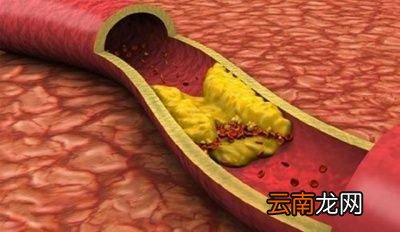 丹参片可以长期吃吗怎么吃