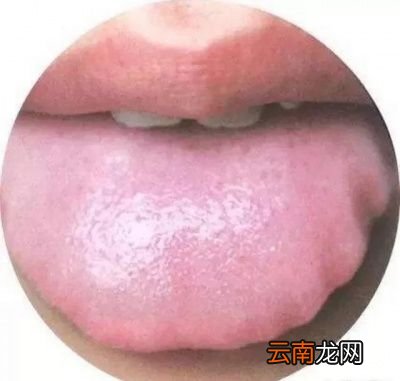有什么穴位按摩可以祛湿