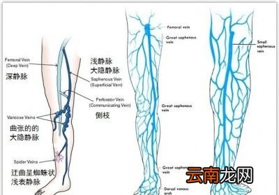 跷二郎腿真的有很大危害吗