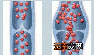 跷二郎腿真的有很大危害吗