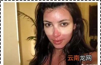 原因就是一直没有做好防晒措施