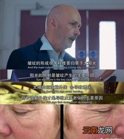 原因就是一直没有做好防晒措施