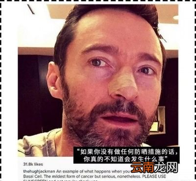 原因就是一直没有做好防晒措施