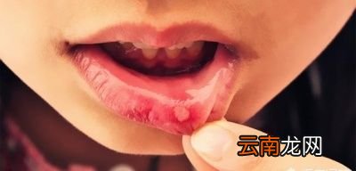 什么是“上火”