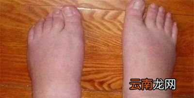 孕妇吃桃子的好处有哪些