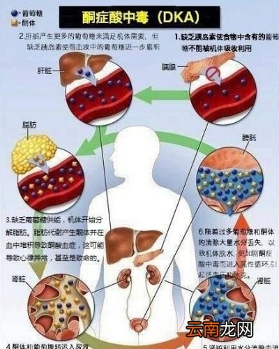 可乐到底有什么危害