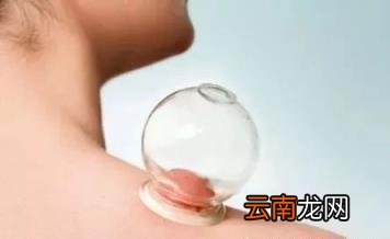 拔罐到底要怎样拔才好?太多人都做错了!