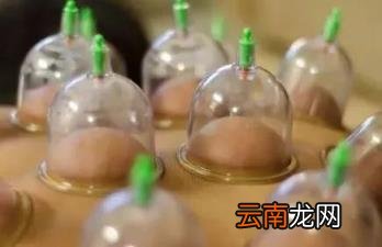 拔罐到底要怎样拔才好?太多人都做错了!
