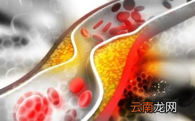 吃猪大油会不会引起心血管疾病