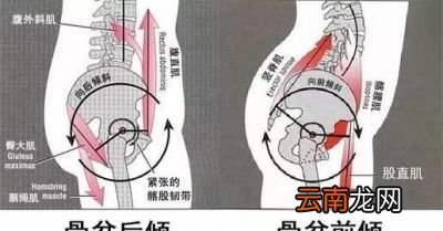 什么情况下踮脚尖对髋关节会产生潜在伤害