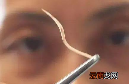 鱼刺卡喉咙能不能自愈 鱼刺卡喉咙怎么办