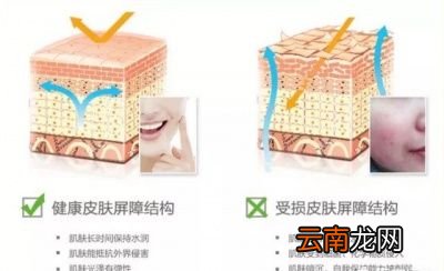 敏感皮肤如何抗皱防衰老