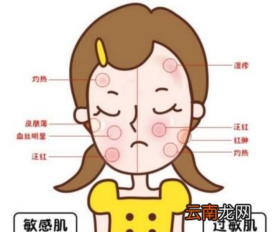 敏感肌护肤应该如何护理