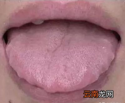 湿气重平时该如何祛湿才好
