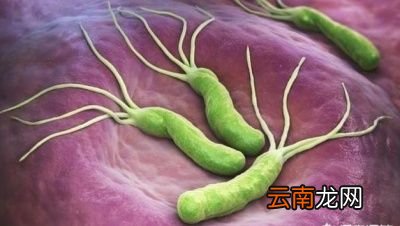 你可以做2件事来降低感染幽门螺杆菌的几率