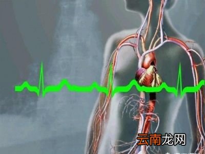 如何预防心绞痛