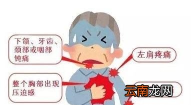 心绞痛有哪些症状