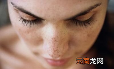 02如何对抗斑点