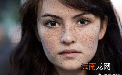 02如何对抗斑点