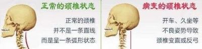 到底是治疗椎间盘突出还是治疗症状