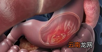 从酒精代谢过程看酗酒引起哪些疾病