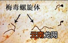 梅毒能彻底治愈吗