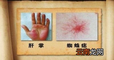 养肝最好的方式是什么