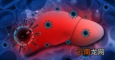 养肝的“冠军”是什么
