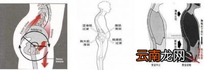 为什么你会腰不好