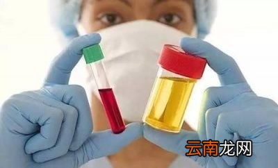 尿酸高的人不碰2物指的哪2物