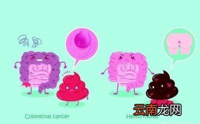 怎样缓解便秘呢