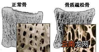 对于50岁的女性来说可以吃什么补品