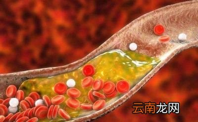 对于50岁的女性来说可以吃什么补品